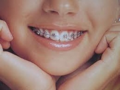 Ortodonti (tel tedavisi) hangi yaş guruplarında uygulanabilir?